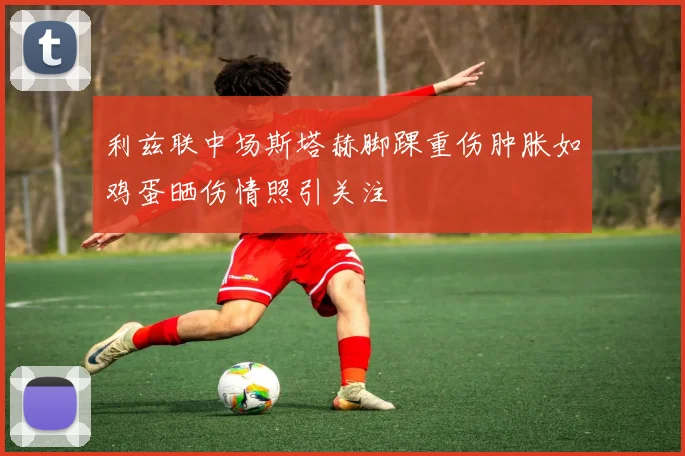 利兹联中场斯塔赫脚踝重伤肿胀如鸡蛋晒伤情照引关注